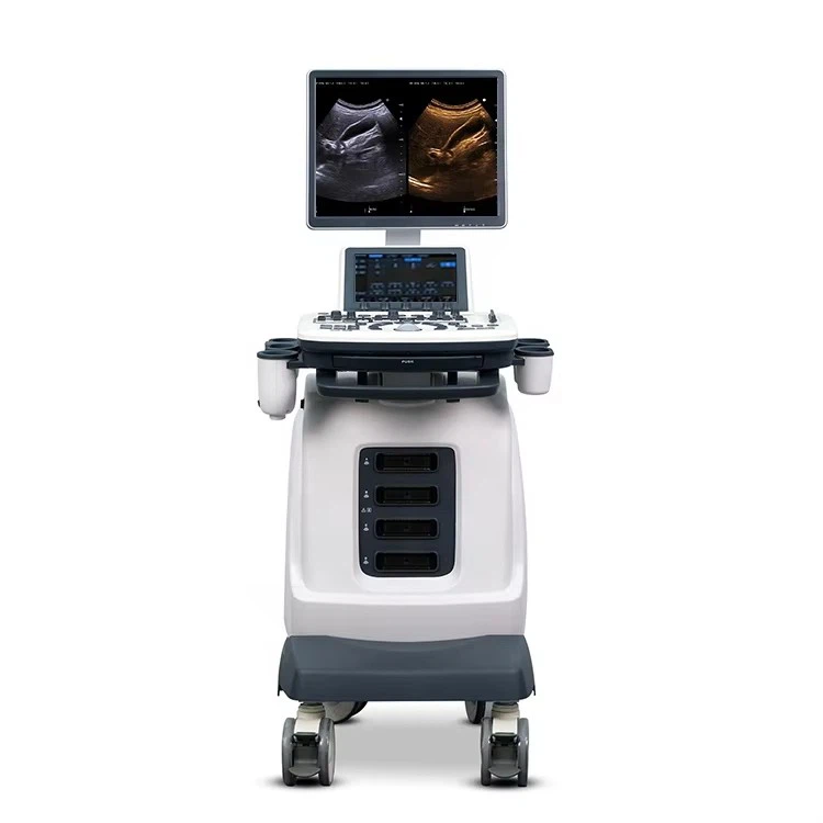 Portable Color Doppler Ultrasound Machine FTL-S7