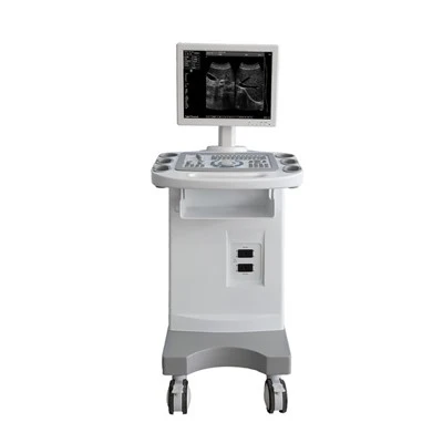 Trolley B/W UltraSound FTL-UTS80